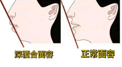 四、贵阳柏德口腔半口活动义齿的预约方式