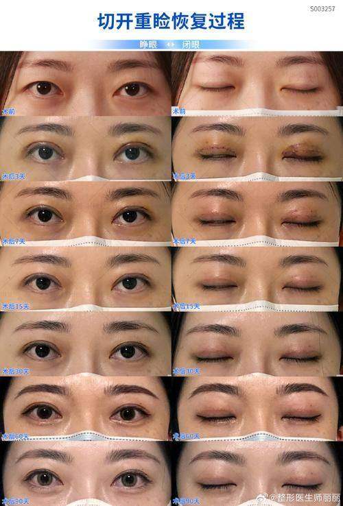 盐城宸熙医疗美容门诊部诊疗项目：