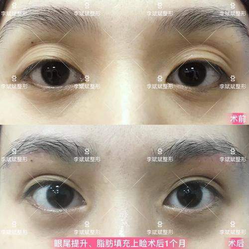 盐城宸熙医疗美容门诊部地址电话及预约挂号方式：