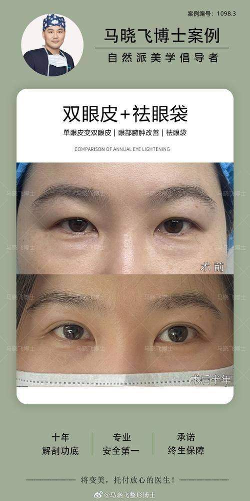 盐城宸熙医疗美容门诊部口碑怎么样？