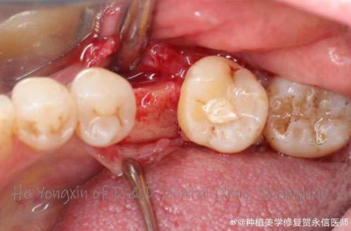 北京梧桐口腔诊所价格表