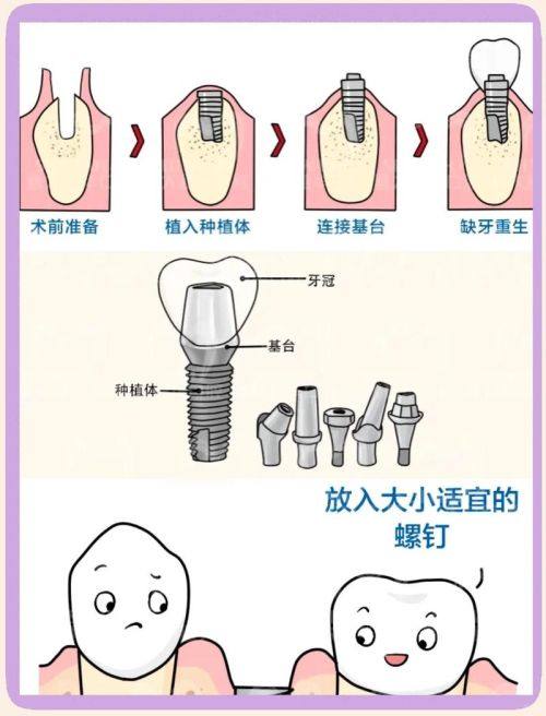 深圳利尚齿科口腔中环店怎么样？