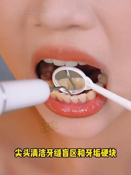 淄博海全口腔价格表