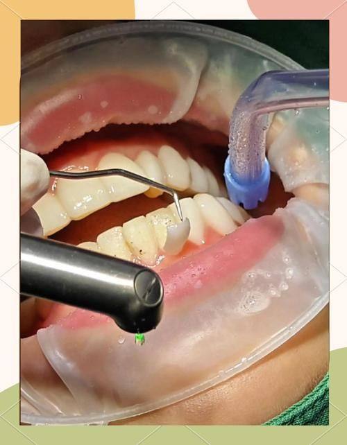 平顶山汝州旭辉口腔口碑评价