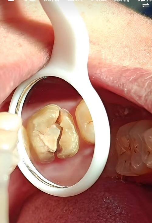 正恩口腔门诊部（岗头店）擅长项目：