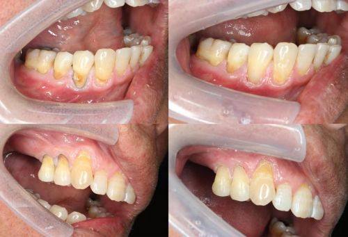 正恩口腔门诊部（岗头店）价格表