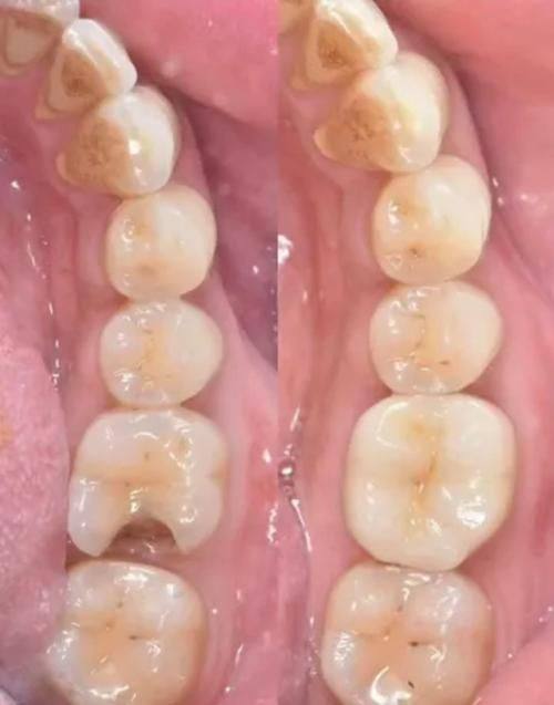 淄博海全口腔怎么样？