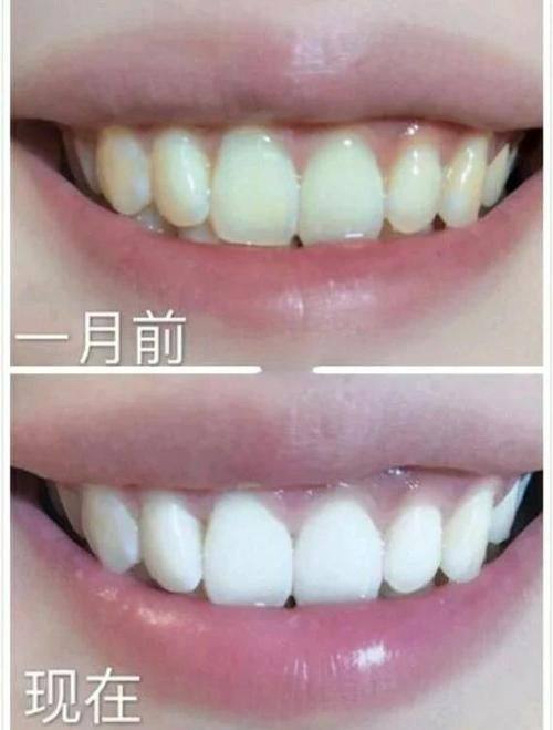 平顶山汝州旭辉口腔地址电话及营业时间