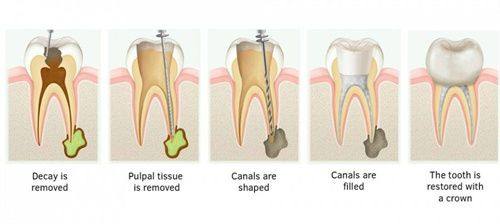 侯马悦冠口腔诊所价格表：