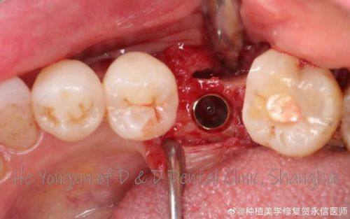 辽宁鞍山泰明口腔门诊部怎么样？