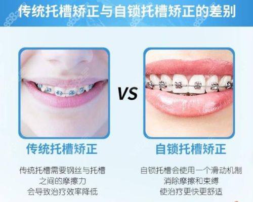 普洱利齿口腔地址电话及营业时间