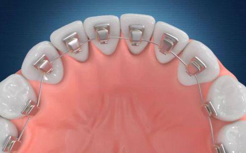 普洱利齿口腔怎么样？