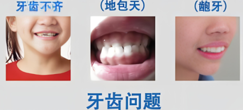 鸡蛋这么吃，既补营养又不刺激创口