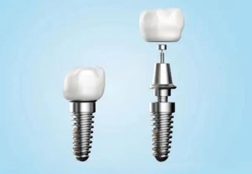 拔牙后吃鸡蛋会发烧吗？对修复有影响吗