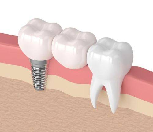 北京众博医院众博口腔诊所怎么样？