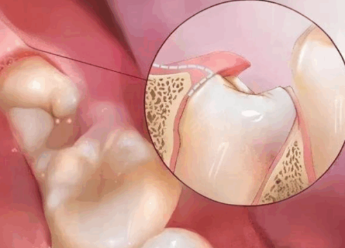 五、品牌积淀与临床保护：给修复成效上“保险”