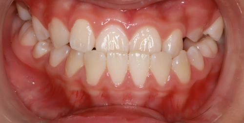 四、经期洗牙的注意事项（若选择洗牙）