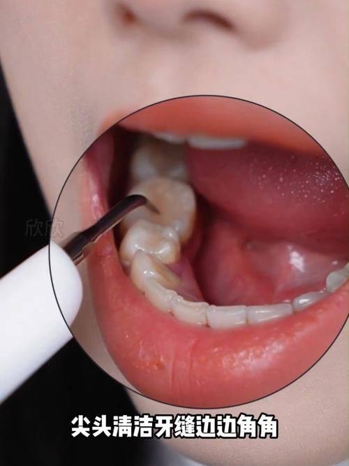 佛山顺齿口腔(顺德店)口碑评价：