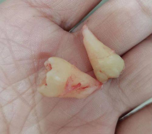 新疆美奥口腔门诊预约挂号方式：