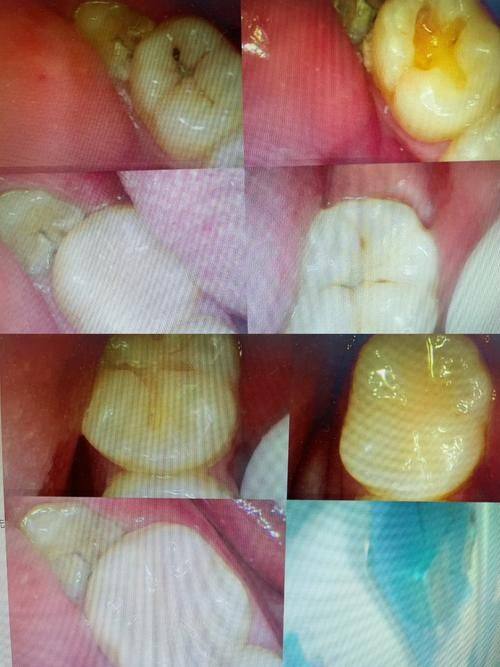泰安丽齿口腔医院口碑评价