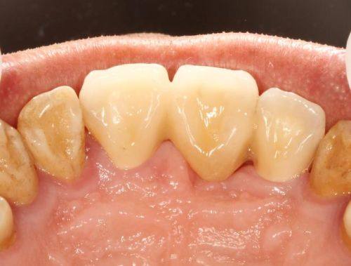 金华靓齿口腔口碑评价：