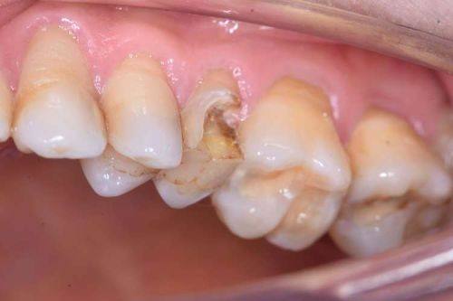 泰安丽齿口腔医院怎么样？