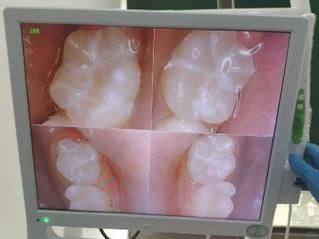 新疆美奥口腔门诊价格表：