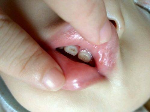 雁塔健齿象口腔医院擅长项目：