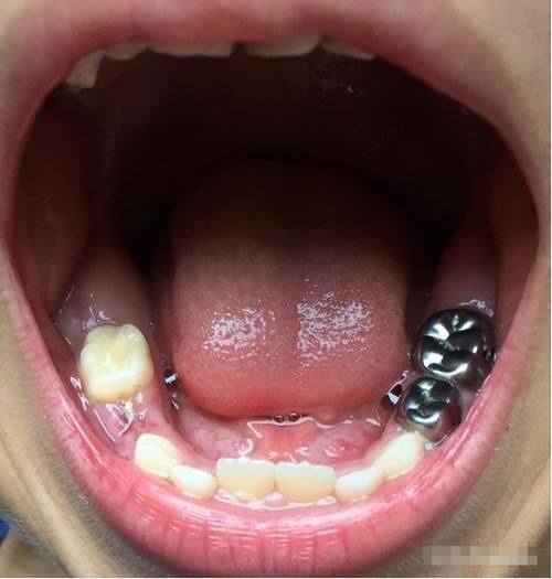 临汾侯马市松阳口腔地址电话及营业时间