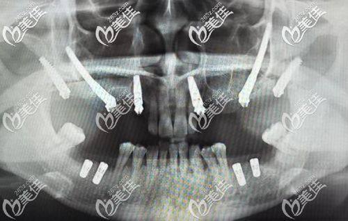 北京京大博爱口腔门诊部价格表