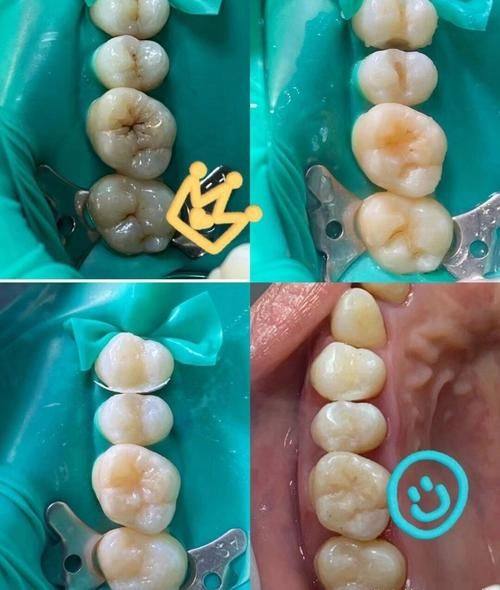 华容皇贝口腔门诊部口碑评价：