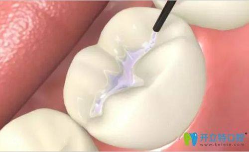 华容皇贝口腔门诊部价格表：