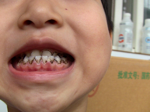 河南南阳方城万超口腔诊所地址电话及营业时间：