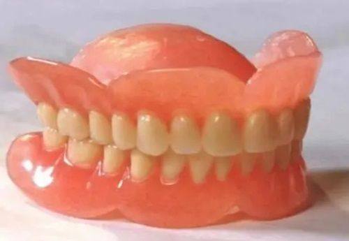 三、无挂钩附着体式单颗活动义齿安装细节解析