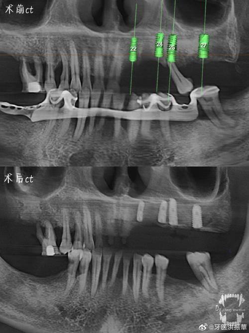 广东口腔医院口碑评价: