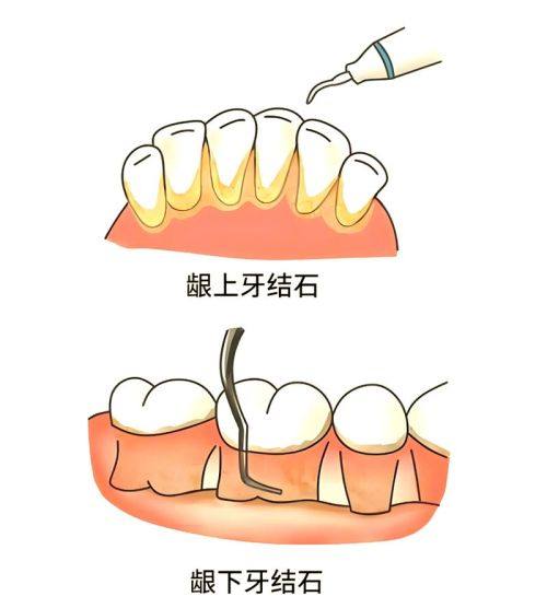 广东口腔医院预约挂号方式: