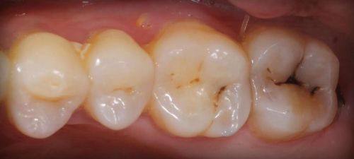 罗平县金冠口腔诊所价格表