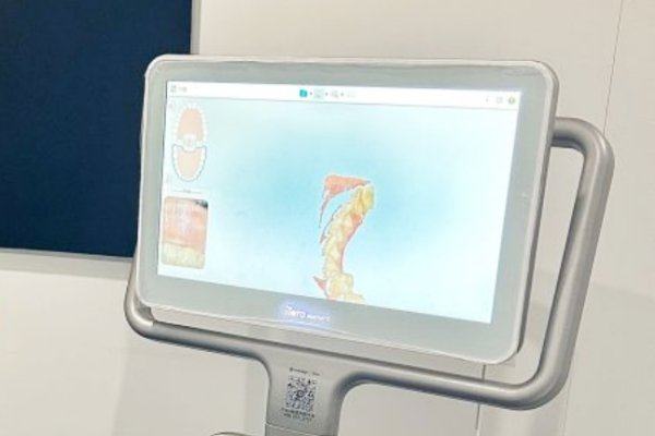 四、上海美奥口腔门诊部术后护理：细致叮嘱助力无肿无疼快速修复