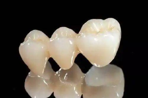 四、根管治疗和补牙的操作相关疑问