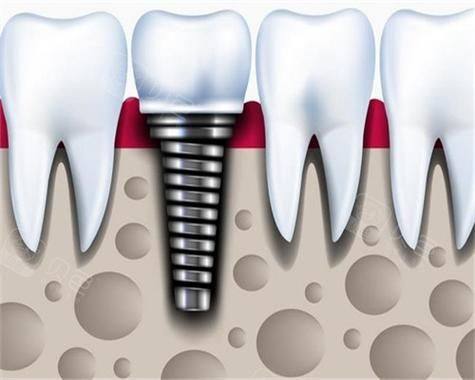 杭州萧山黄凯口腔诊所擅长项目：