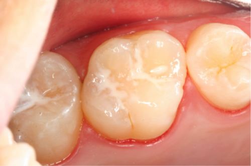 延吉百思特口腔门诊预约挂号方式
