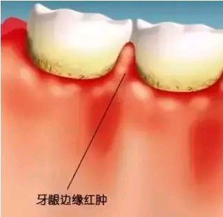 三、韩国奥齿泰种植牙质量怎么样？技术与临床表现双保护