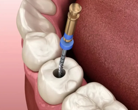 济南张涛口腔诊所擅长项目: