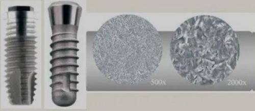 四、乳牙根管治疗的那些注意事项，家长别踩坑