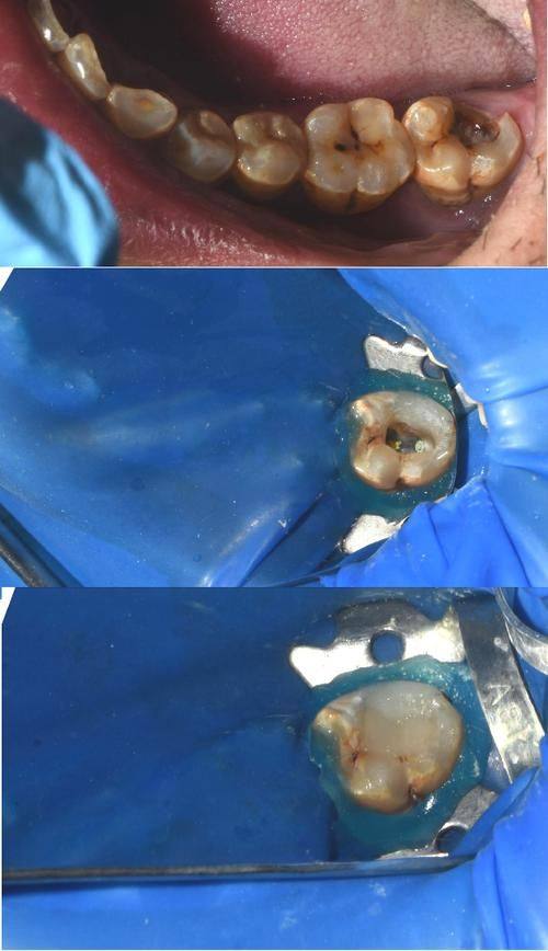 广西柳州品冠口腔门诊部口碑评价：