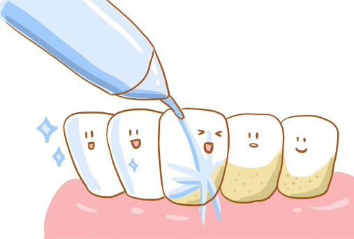 三、按龋齿程度选补牙材料，科学保护剩余牙体