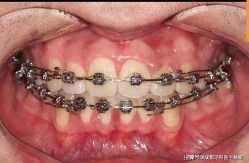 广东汕头定泉口腔口碑评价：