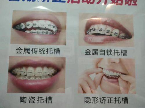 广东汕头定泉口腔地址电话及营业时间：