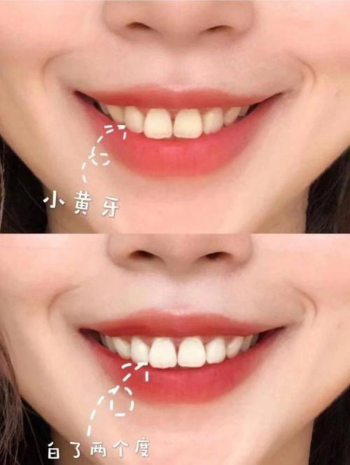 山东淄博张店天祥口腔擅长项目