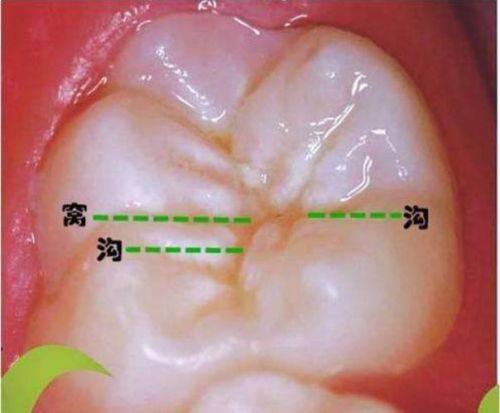 广东汕头定泉口腔预约挂号方式：